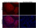 BCL-XL Antibody in Immunohistochemistry (Paraffin) (IHC (P))