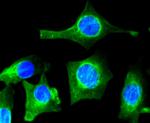 VEGF Antibody in Immunocytochemistry (ICC/IF)