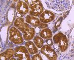 VEGF Antibody in Immunohistochemistry (Paraffin) (IHC (P))