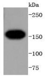 VEGF Receptor 1 Antibody in Western Blot (WB)