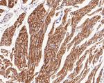 Caveolin 3 Antibody in Immunohistochemistry (Paraffin) (IHC (P))