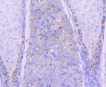 N-cadherin Antibody in Immunohistochemistry (Paraffin) (IHC (P))