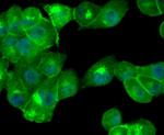 Cathepsin D Antibody in Immunocytochemistry (ICC/IF)