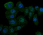 Cathepsin D Antibody in Immunocytochemistry (ICC/IF)