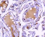 Cathepsin D Antibody in Immunohistochemistry (Paraffin) (IHC (P))