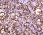 Cathepsin D Antibody in Immunohistochemistry (Paraffin) (IHC (P))