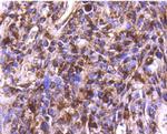 Cathepsin D Antibody in Immunohistochemistry (Paraffin) (IHC (P))