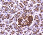 Cathepsin D Antibody in Immunohistochemistry (Paraffin) (IHC (P))