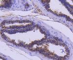 Cathepsin D Antibody in Immunohistochemistry (Paraffin) (IHC (P))