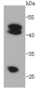 Cathepsin D Antibody in Western Blot (WB)