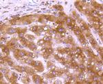 Calreticulin Antibody in Immunohistochemistry (Paraffin) (IHC (P))