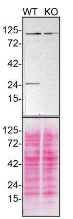 RAB5 Antibody in Western Blot (WB)