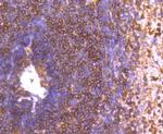 GRK2 Antibody in Immunohistochemistry (Paraffin) (IHC (P))