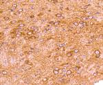 GRK2 Antibody in Immunohistochemistry (Paraffin) (IHC (P))