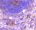 GRK2 Antibody in Immunohistochemistry (Paraffin) (IHC (P))