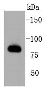 GRK2 Antibody in Western Blot (WB)