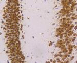 hnRNP K Antibody in Immunohistochemistry (Paraffin) (IHC (P))