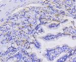 Catenin alpha-1 Antibody in Immunohistochemistry (Paraffin) (IHC (P))