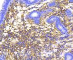 Catenin alpha-1 Antibody in Immunohistochemistry (Paraffin) (IHC (P))