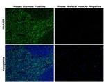 HLA-DR Antibody in Immunohistochemistry (Paraffin) (IHC (P))