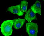 MyD88 Antibody in Immunocytochemistry (ICC/IF)