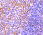 MyD88 Antibody in Immunohistochemistry (Paraffin) (IHC (P))