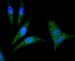 RhoA Antibody in Immunocytochemistry (ICC/IF)