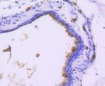 MUC1 Antibody in Immunohistochemistry (Paraffin) (IHC (P))