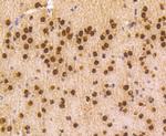 hnRNP C1/C2 Antibody in Immunohistochemistry (Paraffin) (IHC (P))