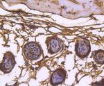 hnRNP C1/C2 Antibody in Immunohistochemistry (Paraffin) (IHC (P))