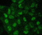 LC3A Antibody in Immunocytochemistry (ICC/IF)