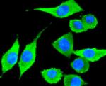 CD81 Antibody in Immunocytochemistry (ICC/IF)