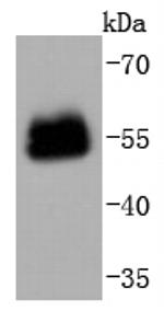 PAX6 Antibody in Western Blot (WB)