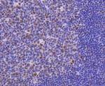 CDK9 Antibody in Immunohistochemistry (Paraffin) (IHC (P))