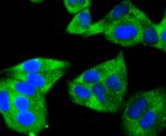 HSPB8 Antibody in Immunocytochemistry (ICC/IF)