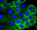 HSPB8 Antibody in Immunocytochemistry (ICC/IF)