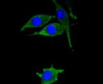 HSPB8 Antibody in Immunocytochemistry (ICC/IF)