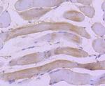 HSPB8 Antibody in Immunohistochemistry (Paraffin) (IHC (P))