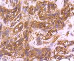 Cdc42 Antibody in Immunohistochemistry (Paraffin) (IHC (P))