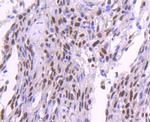 SP1 Antibody in Immunohistochemistry (Paraffin) (IHC (P))