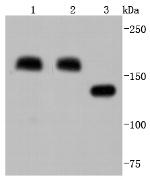 CD206 (MMR) Antibody in Western Blot (WB)