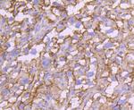 CD71 (Transferrin Receptor) Antibody in Immunohistochemistry (Paraffin) (IHC (P))