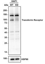 CD71 (Transferrin Receptor) Antibody in Immunohistochemistry (Paraffin) (IHC (P))