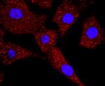 TK1 Antibody in Immunocytochemistry (ICC/IF)