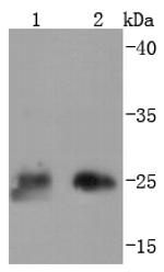 TK1 Antibody in Western Blot (WB)