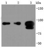 FOXP1 Antibody in Western Blot (WB)