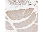 Actin Antibody in Immunohistochemistry (Paraffin) (IHC (P))