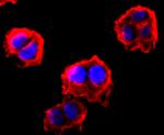 FGFR3 Antibody in Immunocytochemistry (ICC/IF)