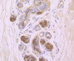 CD104 (Integrin beta 4) Antibody in Immunohistochemistry (Paraffin) (IHC (P))