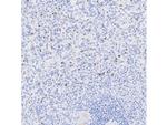 TIA-1 Antibody in Immunocytochemistry (ICC/IF)